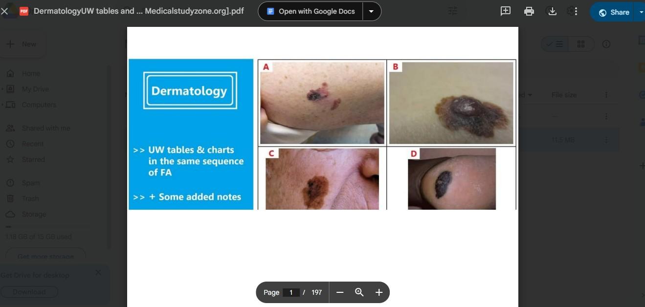 tables and charts u world