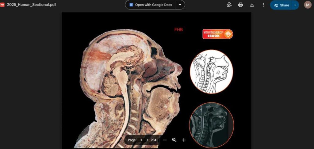 how to download Human sectional anatomy; Atlas of body sections, CT and MRI images pdf