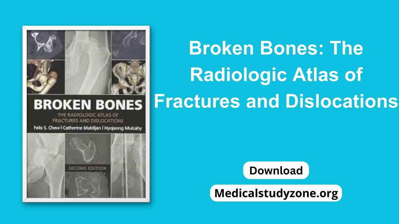 Broken Bones The Radiologic Atlas of Fractures and Dislocations