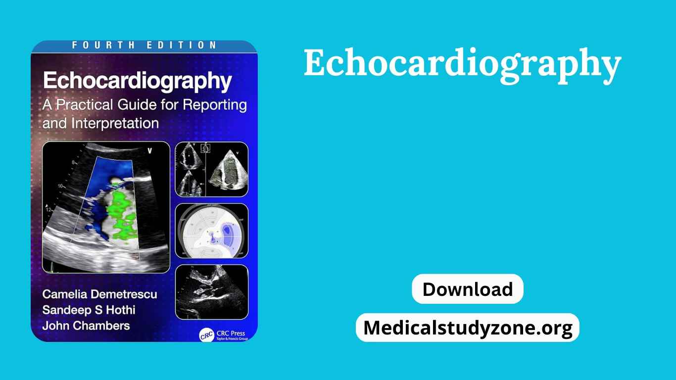 Echocardiography A practical Guide for Reporting and interpretation